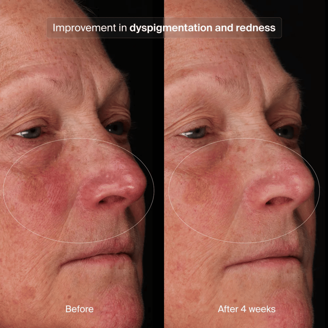 Pavise Bioadaptive Stress Repair Serum