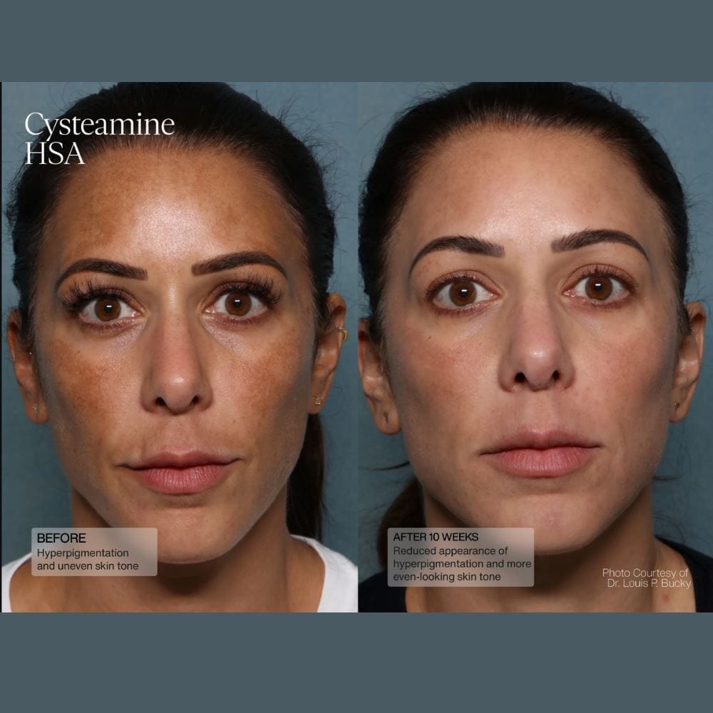 Sente Pigment & Tone Correcting Mask