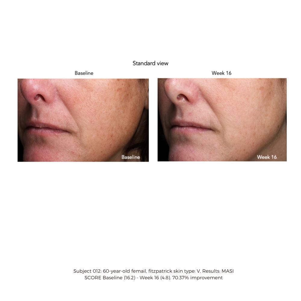 Sente Pigment & Tone Correcting Mask