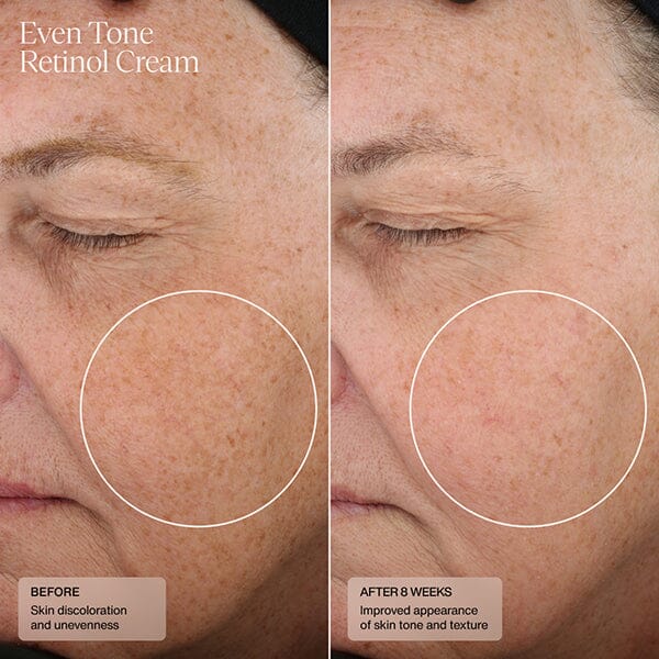 Sente Even Tone Retinol Cream